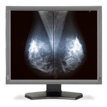 NEC DISPLAY MD211G5 DIAGNOSTIC DISPLAY RECEIVES FDA CLEARANCE FOR USE IN TOMOSYNTHESIS